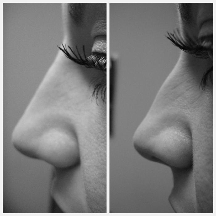 Einfluss der Form der Nase auf den Charakter