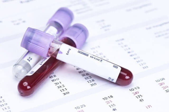 Wie man einen Bluttest für Sterilität besteht?