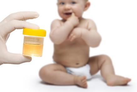 Worüber wird die Urinanalyse (Entschlüsselung) bei Kindern berichten?