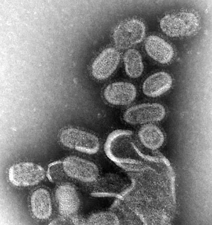 Influenzavirus h1n1